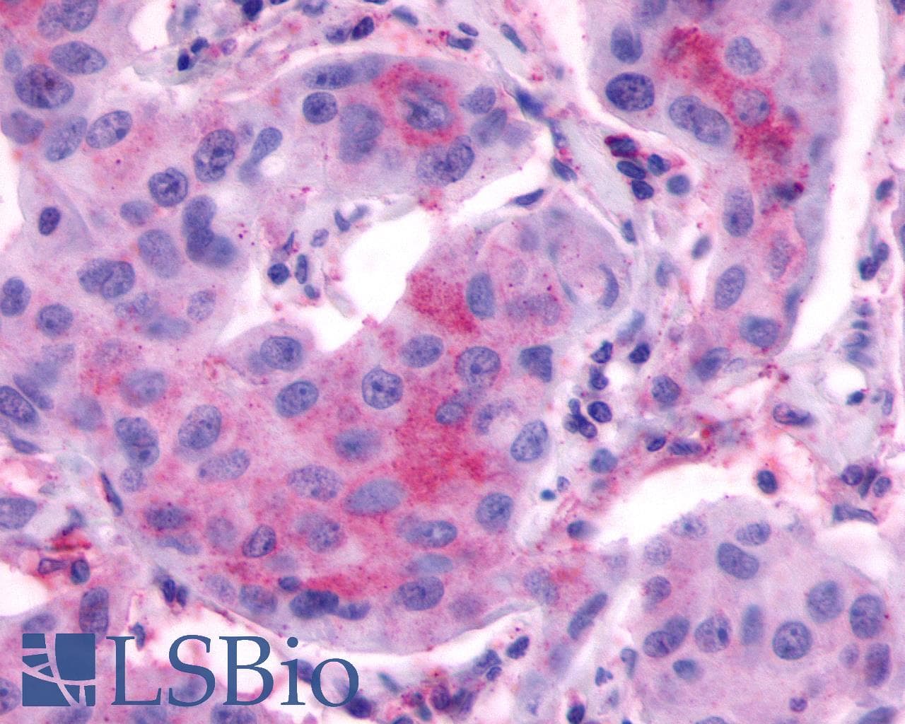 PathPlus™ LHCGR / LHR / LH Receptor Antibody (C-Terminus)