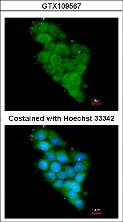 NDUFA12 / B17.2 Antibody (aa1-145)