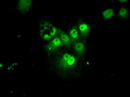 PSMA7 Antibody (clone OTI8F9)