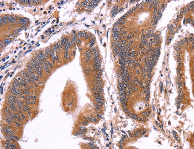 CRISP3 Antibody