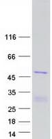 Human ZNF830 / CCDC16 Protein (Recombinant Myc-DDK (Flag))