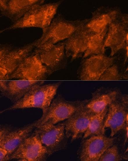 Polyclonal Rabbit anti-Human IPO4 Antibody (IF)