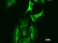 HARS Antibody (clone HARSA6)