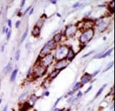GRK5 Antibody (aa559-590)