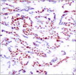 Polyclonal Rabbit anti-Human ATF2 Antibody (IHC, WB)