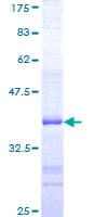 Human CSPG5 / Neuroglycan C Protein (Recombinant GST, N-terminus)