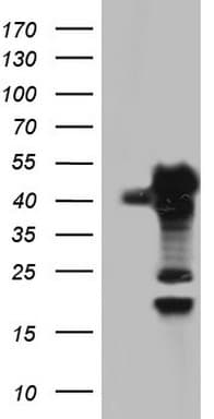 SAE1 Antibody (clone OTI3C3)