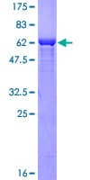 Human FBP1 Protein (Recombinant GST)