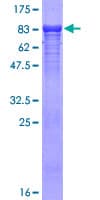 Human TBL1X / TBL1 Protein (Recombinant GST)