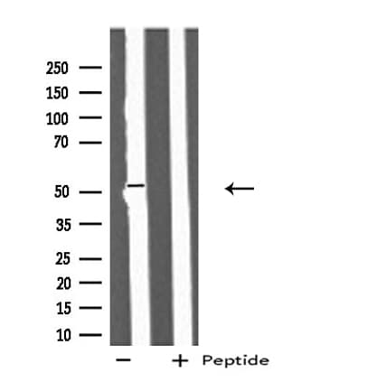 IFIT5 Antibody