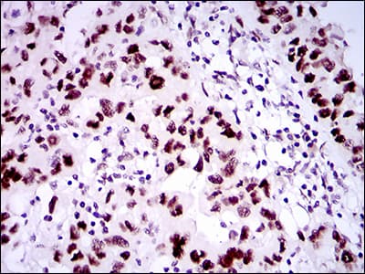 Monoclonal Mouse anti-Human TP53BP1 / 53BP1 Antibody (clone 6B3E10, aa574-773, IHC, WB)