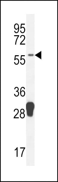 MOCS1 Antibody (aa462-490)