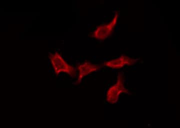Polyclonal Rabbit anti-Human SCN4A / Nav1.4 Antibody (IF, WB)
