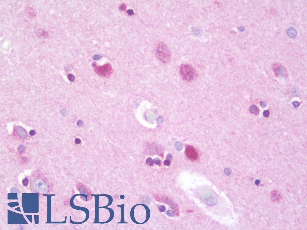 IHC-plus™ Polyclonal Rabbit anti-Human KDELR2 Antibody (aa81-130, IHC, IF, WB)