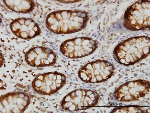HSPA2 Antibody (clone S51)
