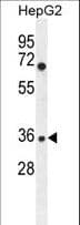 Rabbit Anti-IGHG1 / IgG Secondary Antibody