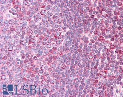 STK38 Antibody