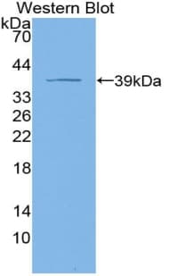 KRT4 / CK4 / Cytokeratin 4 Antibody (aa152-457, FITC)