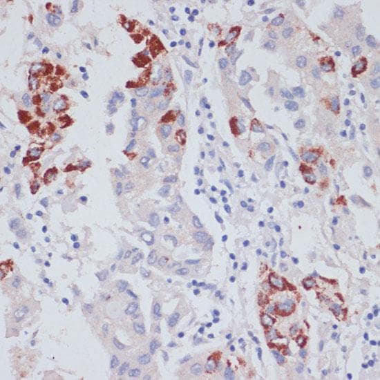 VASP Antibody