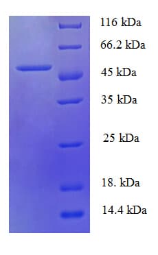 Human HUS1 Protein (Recombinant His-SUMO)