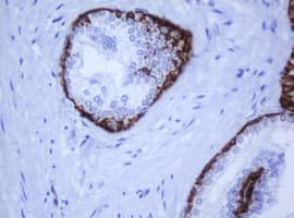 Monoclonal Mouse anti-Human KRT5 / CK5 / Cytokeratin 5 Antibody (clone OTI1F8, IHC)