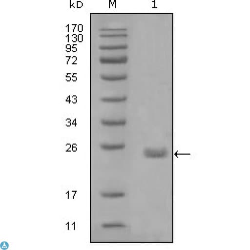 AXL Antibody