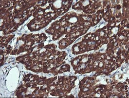 ACAA2 Antibody (clone OTI2G6)