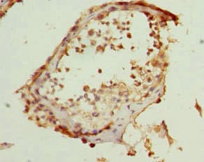ZWINT Antibody