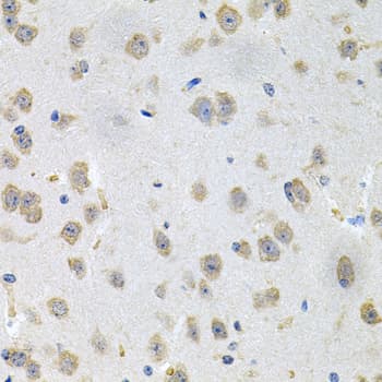GLCNE / GNE Antibody