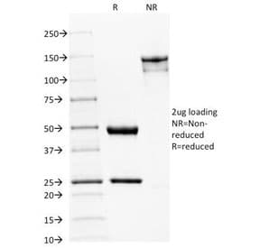 Monoclonal Mouse anti-Human SPTBN2 Antibody (clone SPTBN2/1582, IHC, IF, WB)