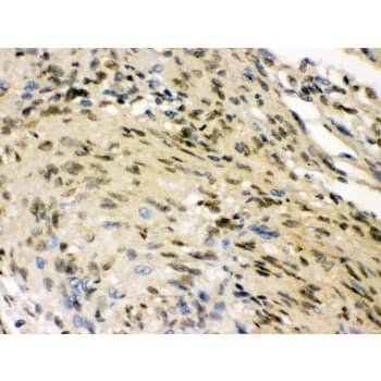 ELAVL4 / HuD Antibody (aa8-45)