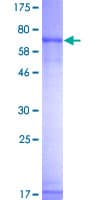 Human TCN1 Protein (Recombinant GST)