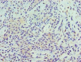 Polyclonal Rabbit anti-Human STAT5B Antibody (aa40-280, IHC, WB)