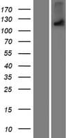 OTOA Protein (Over-Expression Lysate Myc-DDK (Flag))