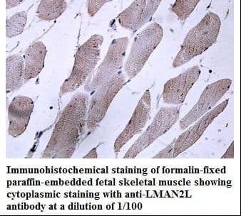 Polyclonal Rabbit anti-Human LMAN2L Antibody (aa164-319, IHC, WB)