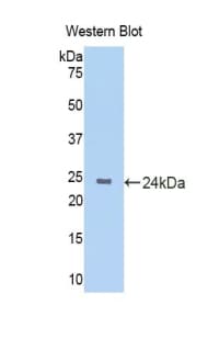KRT4 / CK4 / Cytokeratin 4 Antibody (aa317-454, HRP)