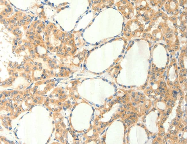Polyclonal Rabbit anti-Human TRPM5 Antibody (IHC, WB)