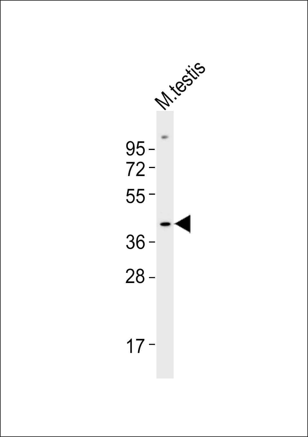 Alpha4GnT / A4GNT Antibody