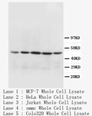 MT-CO1 / COX1 Antibody (N-Terminus, Sepharose)