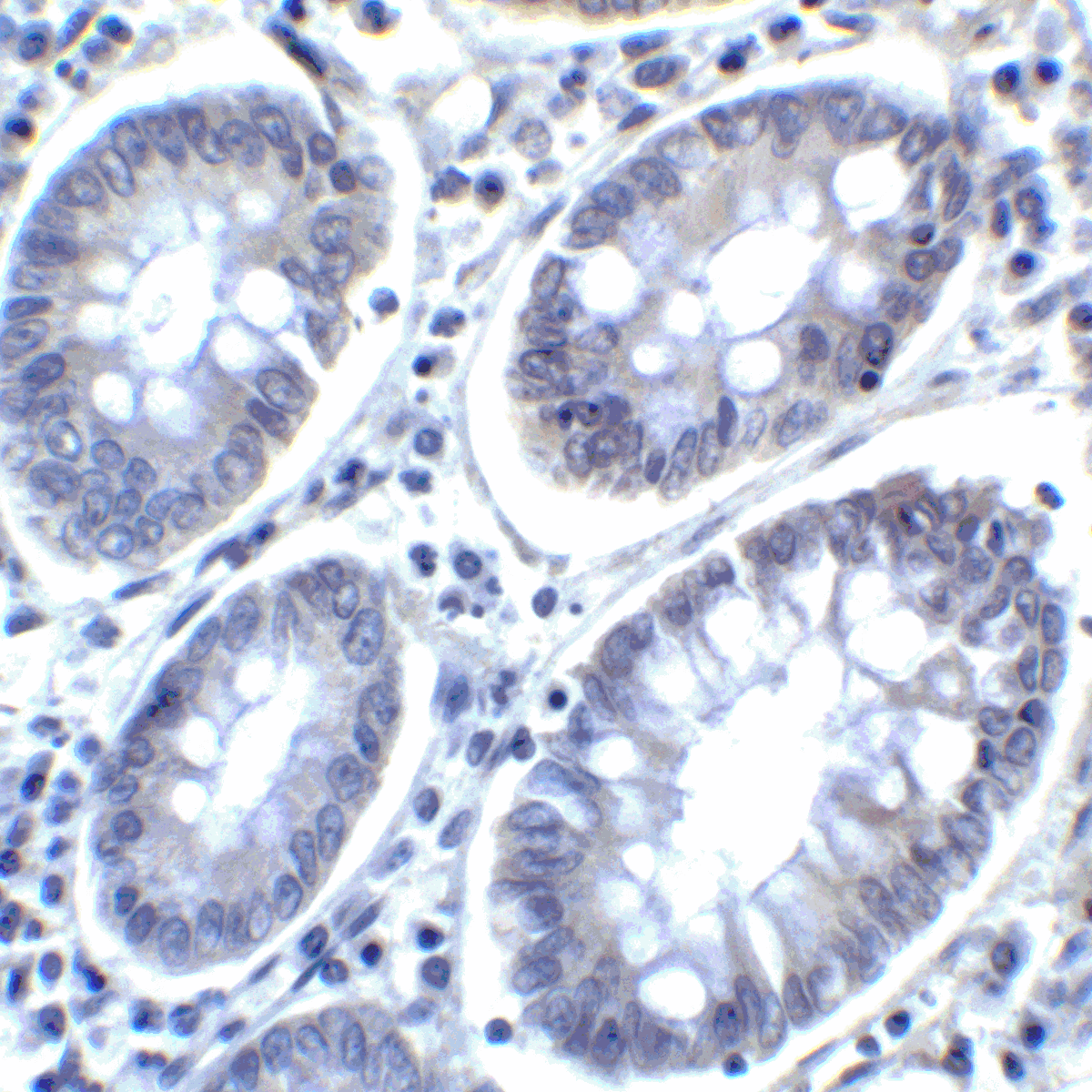 IHC-plus™ PD-L2 / PDCD1LG2 / CD273 Antibody (clone 4E10)