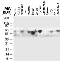Polyclonal Rabbit anti-Mouse TRAF5 Antibody (aa1-20, IHC, WB)
