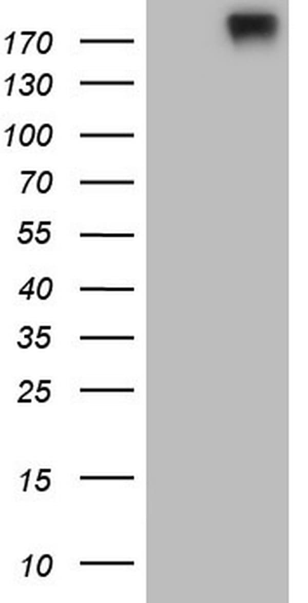 RET Antibody (aa713-1017, clone OTI21H4)