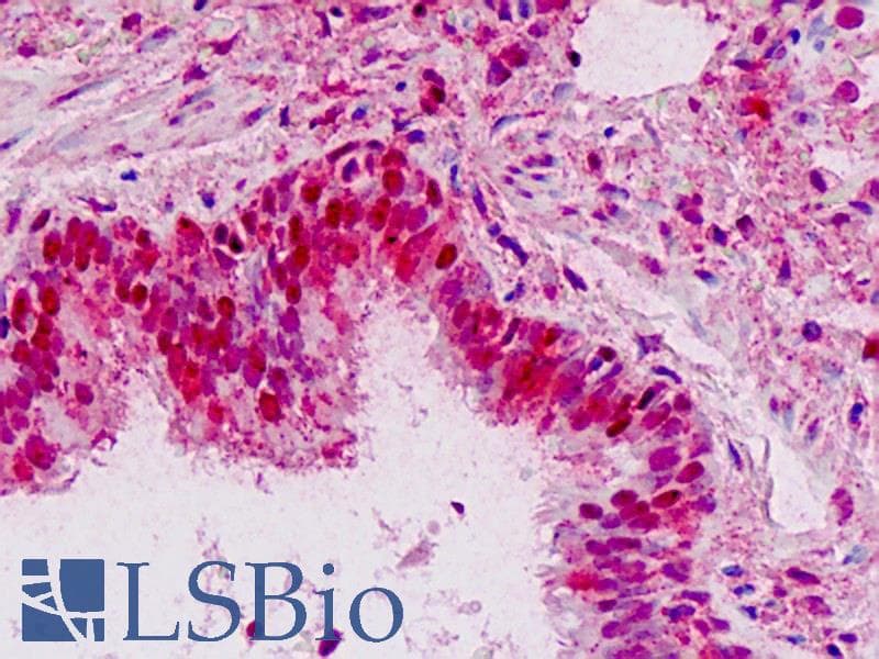 IHC-plus™ PIK3R2 / p85 Beta Antibody (Tyr467)