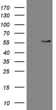 CPM / Carboxypeptidase M Antibody (aa124-423, clone OTI8E2)