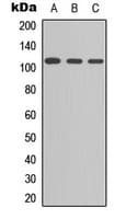 EEF2K Antibody (Internal)