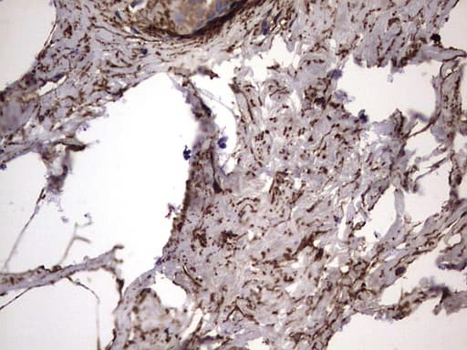 IL1RN Antibody (clone OTI2B1)