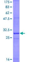 Human KLRG1 Protein (Recombinant GST, N-terminus)