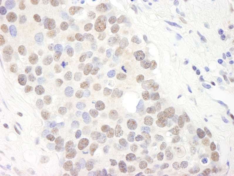 TRIM24 / TIF1 Antibody (aa700-750)