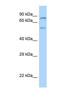 PIAS2 / PIASX Antibody (aa51-100)