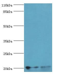 UBCH10 / UBE2C Antibody (aa2-179, HRP)